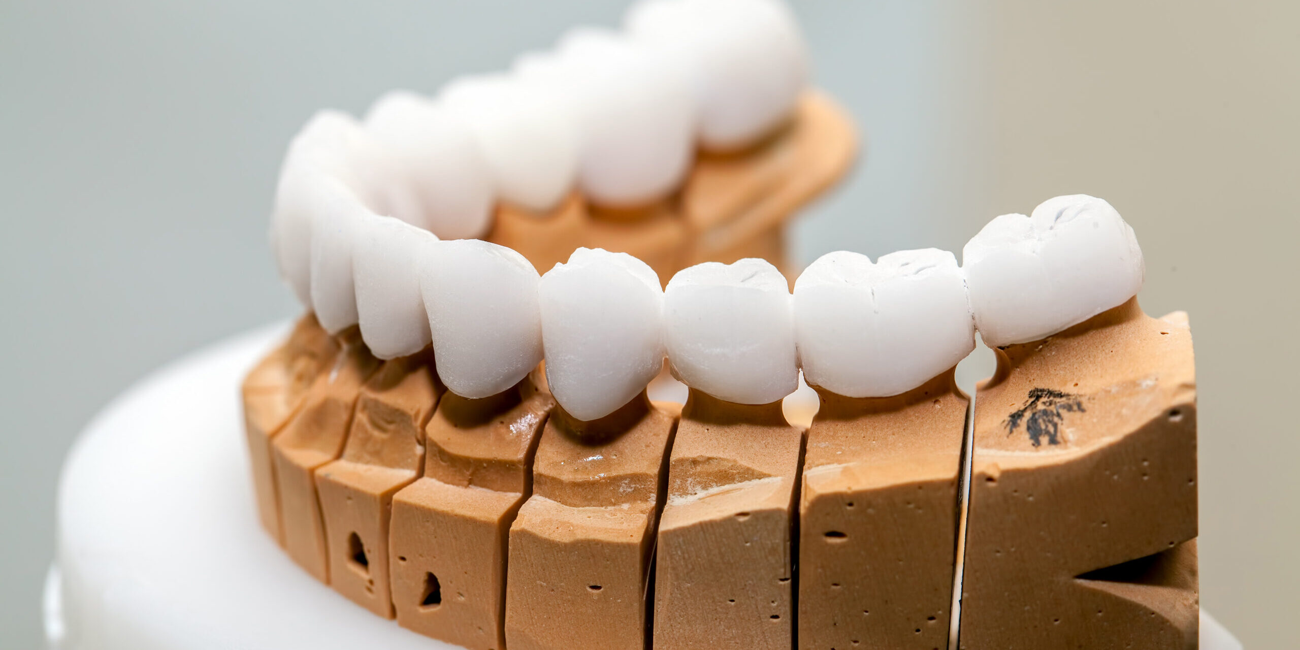 Zirconium Porcelain Tooth plate in Dentist Store